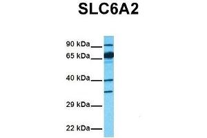 Host:  Rabbit  Target Name:  SLC6A2  Sample Tissue:  Human Fetal Liver  Antibody Dilution:  1. (SLC6A2 Antikörper  (Middle Region))