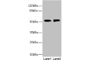 Western blot All lanes: TMOD1 antibody at 2. (CIR1 Antikörper  (AA 1-160))