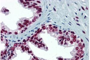 Human Prostate: Formalin-Fixed, Paraffin-Embedded (FFPE) (SP1 Antikörper  (AA 89-199))