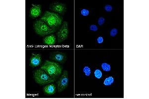 ABIN5539801 Immunofluorescence analysis of paraformaldehyde fixed MCF7 cells, permeabilized with 0. (ESR2 Antikörper  (AA 417-428))