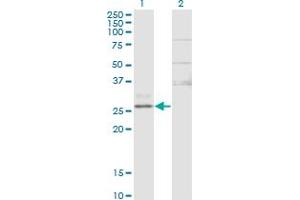 Western Blot analysis of CTRB1 expression in transfected 293T cell line by CTRB1 monoclonal antibody (M02), clone 3C8. (CTRB1 Antikörper  (AA 101-200))