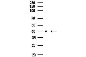 anti-Protein Kinase, CAMP Dependent, Catalytic, beta (PRKACB) (pThr197) antibody