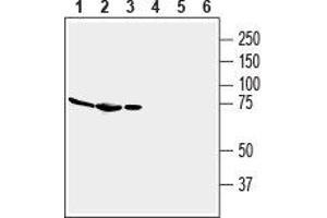 Western blot analysis of mouse brain membranes (lanes 1 and 4), rat brain lysate (lanes 2 and 5) and rat spleen membranes (lanes 3 and 6): - 1-3. (Adenosine A2a Receptor Antikörper  (2nd Extracellular Loop))
