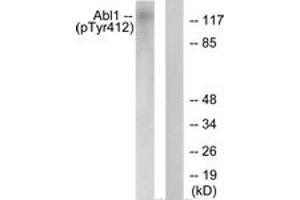 Western blot analysis of extracts from COS7 cells treated with Adriamycin 0. (ABL1 Antikörper  (pTyr393))