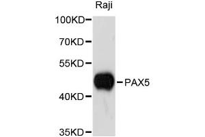 Western blot analysis of extracts of Raji cells, using PAX5 antibody (ABIN1874048) at 1:3000 dilution. (PAX5 Antikörper)
