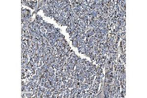 IHC analysis of P4HB using anti-P4HB antibody (ABIN7600075).