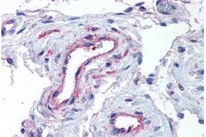 Immunohistochemistry (Paraffin-embedded Sections) (IHC (p)) image for anti-ADAM Metallopeptidase with Thrombospondin Type 1 Motif, 1 (ADAMTS1) (N-Term) antibody (ABIN625843)