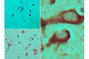 Immunohistochemical analysis of TICAM2 in formalin-fixed, paraffin-embedded human brain tissue using an isotype control (top left) and TICAM2 polyclonal antibody  (bottom left, right) at 5 ug/mL . (TICAM2 Antikörper  (AA 87-103))