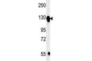 Integrin alpha 5 antibody western blot analysis in mouse bladder tissue lysate. (ITGA5 Antikörper  (AA 796-822))