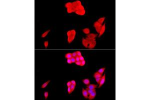 Immunofluorescence analysis of HeLa cells using [KO Validated] SIRT1 Rabbit pAb (ABIN7270322) at dilution of 1:200 (40x lens). (SIRT1 Antikörper)