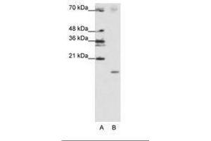 Image no. 2 for anti-Signal Recognition Particle 19kDa (SRP19) (C-Term) antibody (ABIN202029) (SRP19 Antikörper  (C-Term))