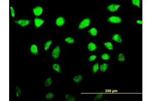 Image no. 1 for anti-A Kinase (PRKA) Anchor Protein 17A (AKAP17A) (AA 53-157) antibody (ABIN599035) (SFRS17A Antikörper  (AA 53-157))