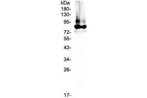 Western blot testing of human plasma lysate with Prothrombin antibody at 0. (Prothrombin Antikörper)
