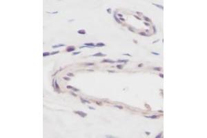 Image no. 5 for anti-Vascular Endothelial Growth Factor A (VEGFA) antibody (ABIN465470) (VEGFA Antikörper)