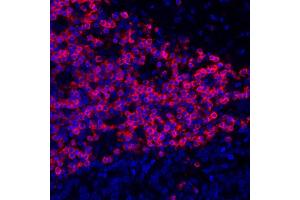 Immunofluorescence (IF) image for anti-CD3 epsilon (CD3E) (AA 157-207) antibody (ABIN7454035) (Rekombinanter CD3 epsilon Antikörper  (AA 157-207))