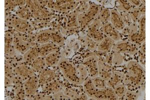 ABIN6261828 and ABIN6274011 at 1/100 staining Rat kidney tissue by IHC-P. (FUBP1 Antikörper  (C-Term))