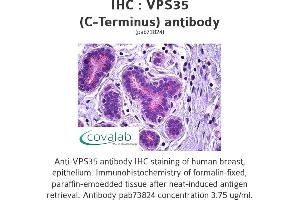 Image no. 1 for anti-Vacuolar Protein Sorting 35 (VPS35) (C-Term) antibody (ABIN1740787) (VPS35 Antikörper  (C-Term))