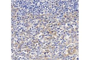 Immunohistochemistry analysis of paraffin-embedded human tonsil using,OAS3 (ABIN7072846) at dilution of 1: 4000 (OAS3 Antikörper)