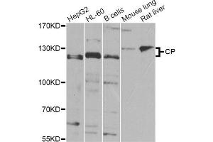 Western blot analysis of extracts of various cell lines, using CP Antibody (ABIN5974460) at 1/1000 dilution. (Ceruloplasmin Antikörper)