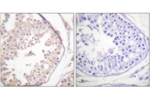 Immunohistochemistry analysis of paraffin-embedded human testis tissue, using RAD52 (Ab-104) Antibody. (RAD52 Antikörper  (AA 70-119))