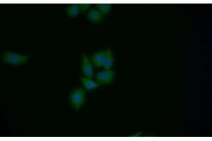 Detection of MGEA5 in Human MCF7 cell using Polyclonal Antibody to Meningioma Expressed Antigen 5 (MGEA5) (MGEA5 Antikörper  (AA 6-240))