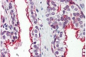 Human Prostate (formalin-fixed, paraffin-embedded) stained with CLU antibody ABIN364331 at 10 ug/ml followed by biotinylated anti-mouse IgG secondary antibody ABIN481714, alkaline phosphatase-streptavidin and chromogen. (Clusterin Antikörper  (AA 1-333))