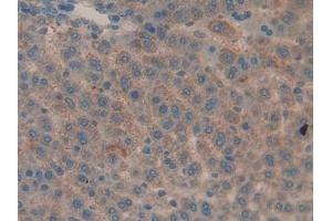Detection of MMP9 in Rat Liver Tissue using Polyclonal Antibody to Matrix Metalloproteinase 9 (MMP9) (MMP 9 Antikörper  (AA 226-391))