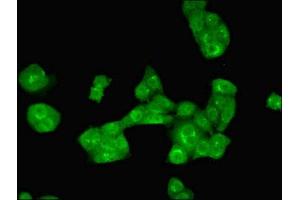 Immunofluorescent analysis of PC-3 cells using ABIN7143886 at dilution of 1:100 and Alexa Fluor 488-congugated AffiniPure Goat Anti-Rabbit IgG(H+L) (ALKBH3 Antikörper  (AA 1-170))