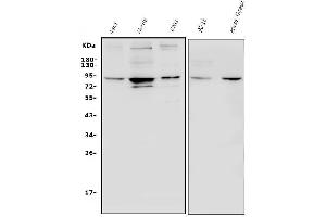 Western blot analysis of HIF-1 alpha/HIF1A using anti-HIF-1 alpha/HIF1A antibody (ABIN7602159).