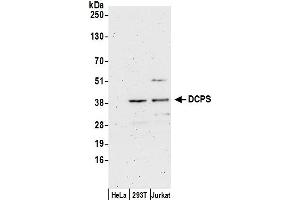 anti-Decapping Enzyme, Scavenger (DCPS) (AA 287-337) antibody