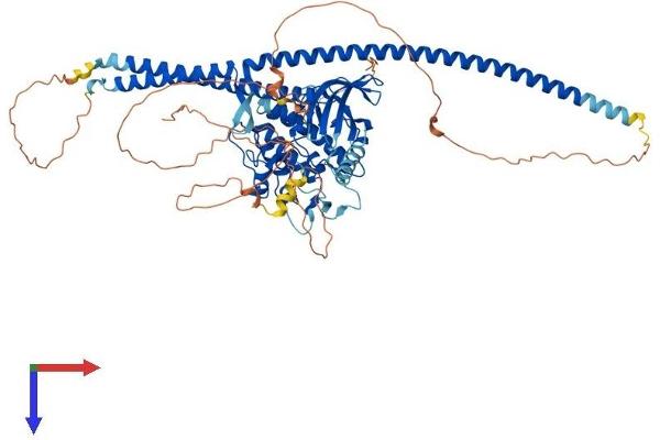 TLK1 Protein (AA 1-766) (His tag)