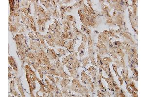 Immunoperoxidase of monoclonal antibody to EIF4G2 on formalin-fixed paraffin-embedded human heart.