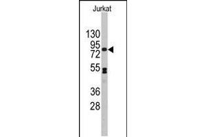 Western blot analysis of anti-CDH12 Antibody in Jurkat cell line lysates (35ug/lane). (Cadherin 12 Antikörper  (N-Term))