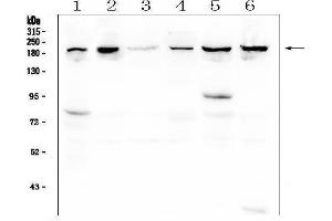 Western blot analysis of CPAMD8 using anti-CPAMD8 antibody (ABIN6719649). (CPAMD8 Antikörper  (AA 58-234))