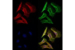 ABIN6258908 and ABIN6275622 staining Hela cells by IF/ICC. (CD1e Antikörper  (Internal Region))