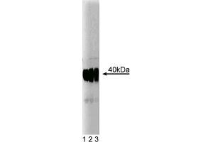 Western Blotting (WB) image for anti-Small Nuclear Ribonucleoprotein Polypeptide N (SNRPN) (AA 14-174) antibody (ABIN968086) (SNRPN Antikörper  (AA 14-174))