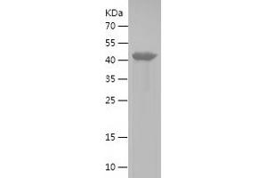 NDRG3 Protein (AA 14-255) (His-IF2DI Tag)
