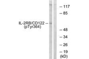 Western blot analysis of extracts from COS7 cells, using IL-2R beta/CD122 (Phospho-Tyr364) Antibody. (IL2 Receptor beta Antikörper  (pTyr364))