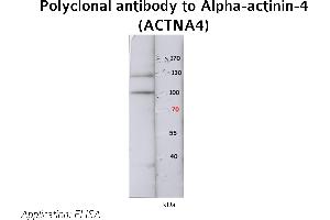 Image no. 1 for anti-Actinin, alpha 4 (ACTN4) (N-Term) antibody (ABIN347113) (alpha Actinin 4 Antikörper  (N-Term))