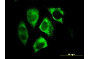 Immunofluorescence of monoclonal antibody to PARK2 on HeLa cell. (Parkin Antikörper  (AA 288-387))