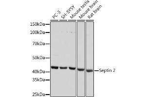 Western blot analysis of extracts of various cell lines, using Septin 2 Rabbit mAb (ABIN7270203) at 1:1000 dilution. (Septin 2 Antikörper)