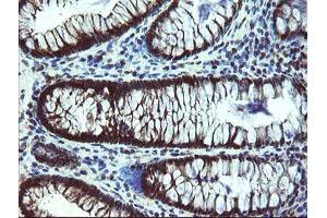 Immunohistochemical staining of paraffin-embedded Human colon tissue using anti-TBCC mouse monoclonal antibody. (TBCC Antikörper)