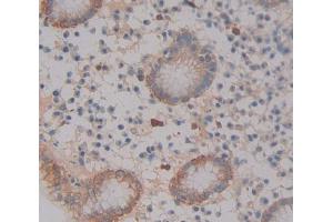 Used in DAB staining on fromalin fixed paraffin- embedded Kidney tissue (ABCA12 Antikörper  (AA 1346-1577))