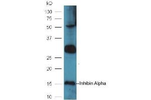 Mouse intestinal lysates probed with Rabbit Anti-Inhibin Alpha Polyclonal Antibody, Unconjugated (ABIN1715125) at 1:300 in 4˚C. (Inhibin alpha Antikörper  (AA 281-366))
