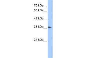 WB Suggested Anti-TIPIN Antibody Titration:  5.
