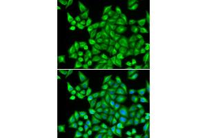 Immunofluorescence analysis of HeLa cells using DHRS9 antibody. (DHRS9 Antikörper)