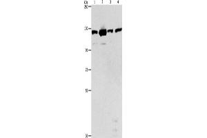 Western Blotting (WB) image for anti-PTK2 Protein tyrosine Kinase 2 (PTK2) antibody (ABIN2422852) (FAK Antikörper)