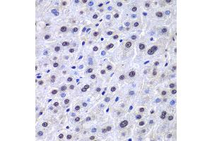 Immunohistochemistry of paraffin-embedded human liver injury using APEX1 antibody at dilution of 1:100 (400x lens). (APEX1 Antikörper)