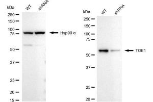 Western blotting analysis using TOE1 antibody (ABIN7800513).