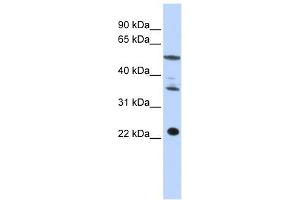 CENPM antibody used at 1 ug/ml to detect target protein. (CENPM Antikörper  (Middle Region))